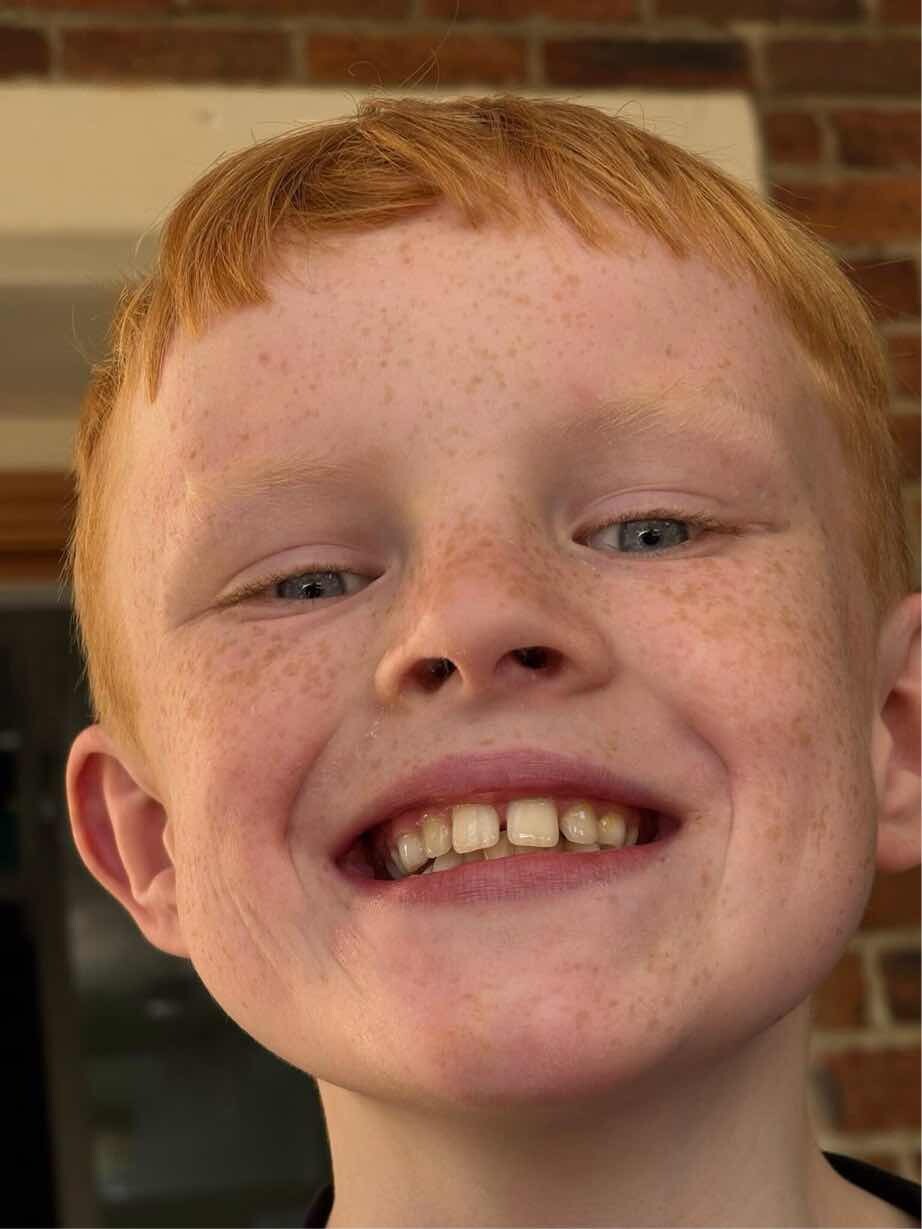x